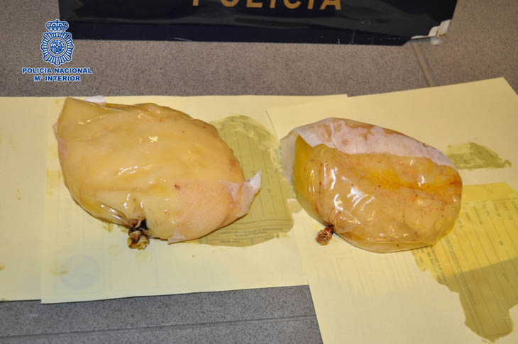 Cocaine in breast implants.