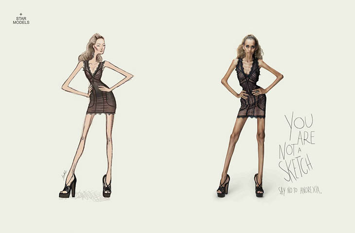 You’re Not A Sketch. Say No To Anorexia