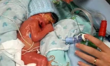 Doctors Said Her Newborn Son Had Died. What She Did? Everyone Was Shocked!